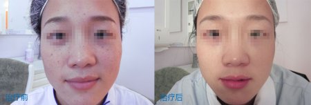 ���ݱ���Ƥ����