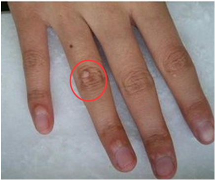 ���ݱ���Ƥ����