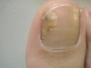 ���ݱ���Ƥ����