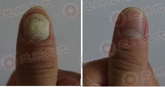 ���ݱ���Ƥ����