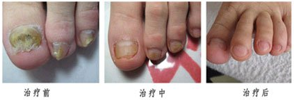 ���ݱ���Ƥ����