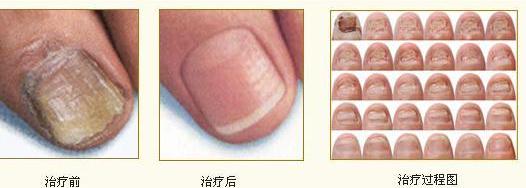 ���ݱ���Ƥ����