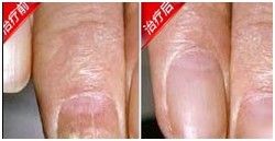 ���ݱ���Ƥ����