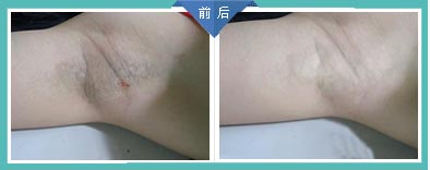 ���ݱ���Ƥ����