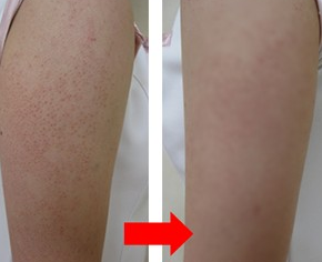 ���ݱ���Ƥ����