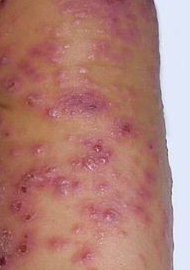 ���ݱ���Ƥ����