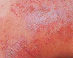 ���ݱ���Ƥ����