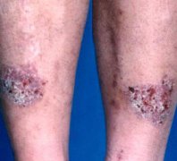 ���ݱ���Ƥ����