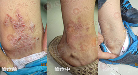 ���ݱ���Ƥ����