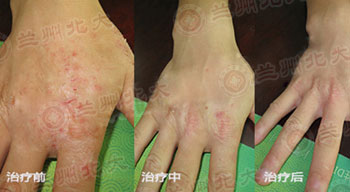 ���ݱ���Ƥ����