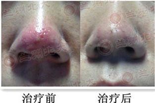 ���ݱ���Ƥ����