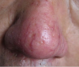 ���ݱ���Ƥ����