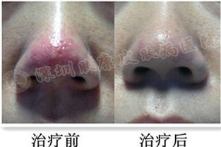 ���ݱ���Ƥ����