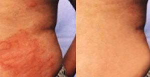 ���ݱ���Ƥ����