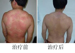 ���ݱ���Ƥ����