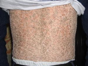 ���ݱ���Ƥ����