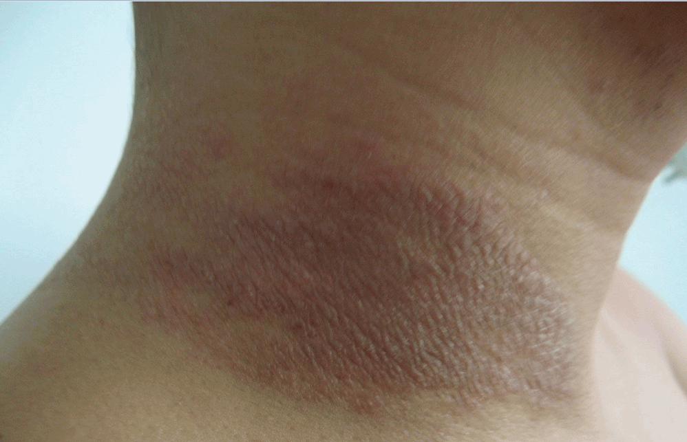 ���ݱ���Ƥ����