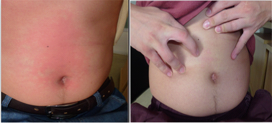 ���ݱ���Ƥ����