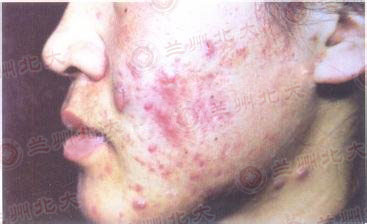 ���ݱ���Ƥ����