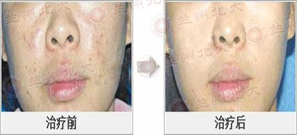 ���ݱ���Ƥ����