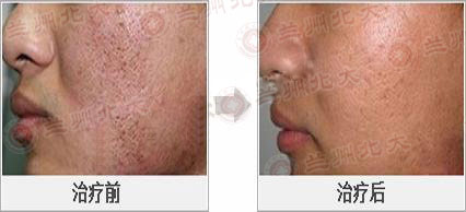 ���ݱ���Ƥ����