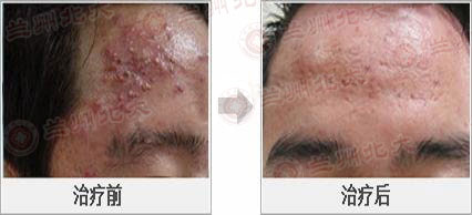 ���ݱ���Ƥ����