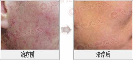 ���ݱ���Ƥ����