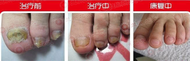 ���ݱ���Ƥ����