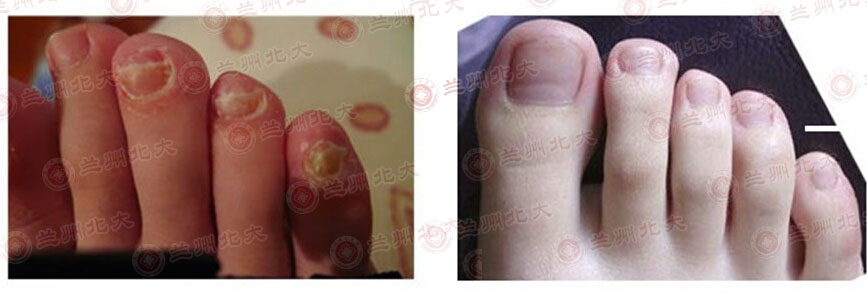 ���ݱ���Ƥ����