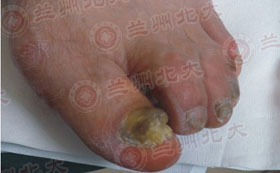 ���ݱ���Ƥ����