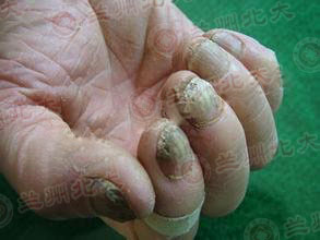 ���ݱ���Ƥ����