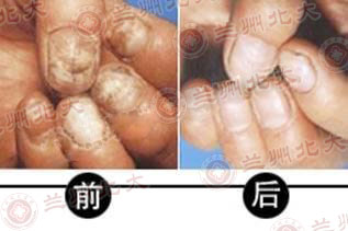 ���ݱ���Ƥ����