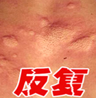 ���ݱ���Ƥ����