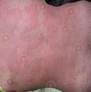 ���ݱ���Ƥ����