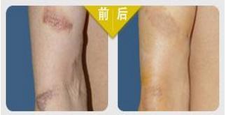 ���ݱ���Ƥ����