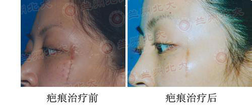 ���ݱ���Ƥ����