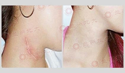 ���ݱ���Ƥ����