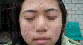 ���ݱ���Ƥ����