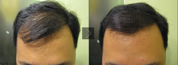 ���ݱ���Ƥ����