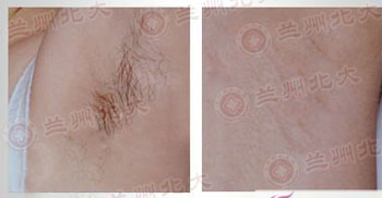 ���ݱ���Ƥ����