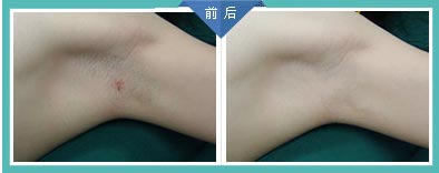 ���ݱ���Ƥ����