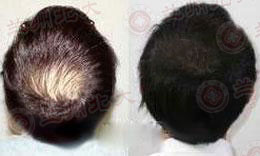 ���ݱ���Ƥ����