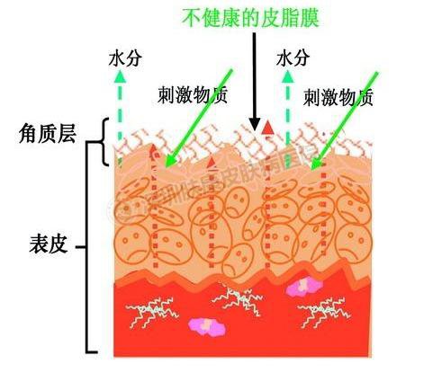 ���ݱ���Ƥ����