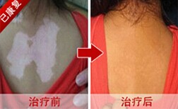 ���ݱ���Ƥ����