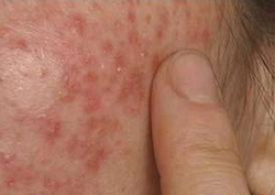 ���ݱ���Ƥ����