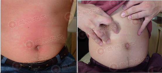 ���ݱ���Ƥ����