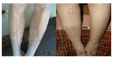 ���ݱ���Ƥ����