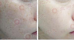 ���ݱ���Ƥ����