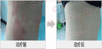 ���ݱ���Ƥ����