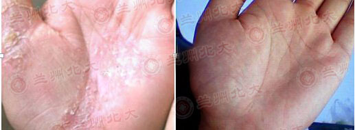 ���ݱ���Ƥ����